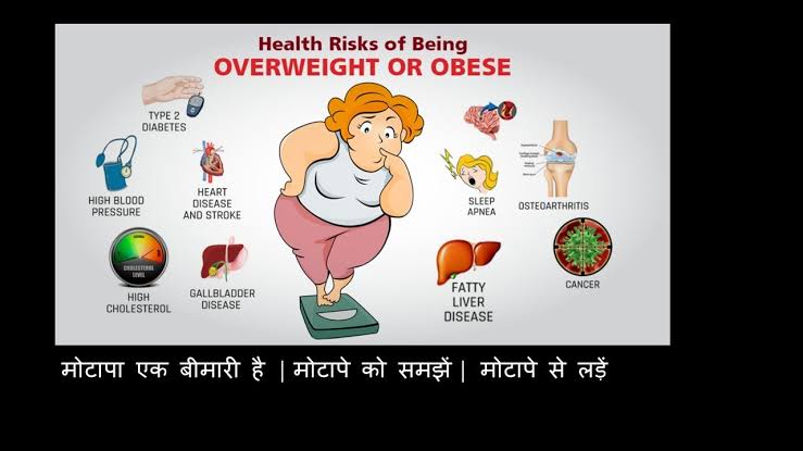 छत्तीसगढ़ मोटापा मुहिम