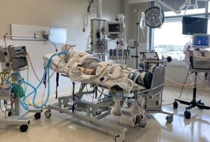 Burn patients will get immediate treatment