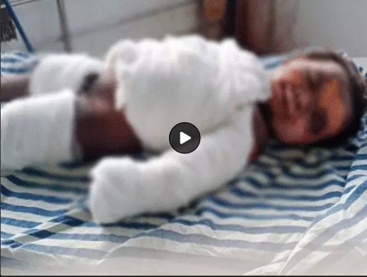Mobile Blast: Caution... Tragic Incident in Chhattisgarh! One-Year-Old Child Dies Tragically After Mobile Battery Explodes.