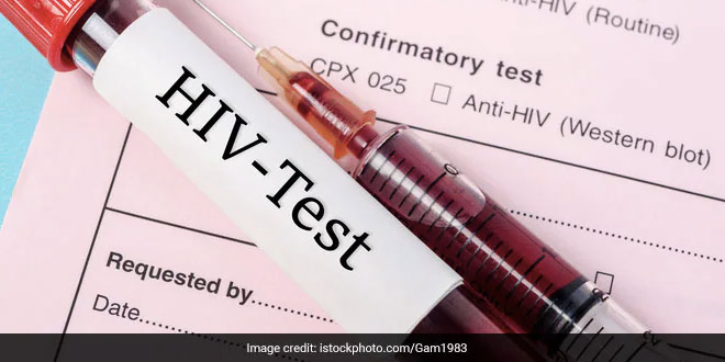 Vaccine Research Against HIV