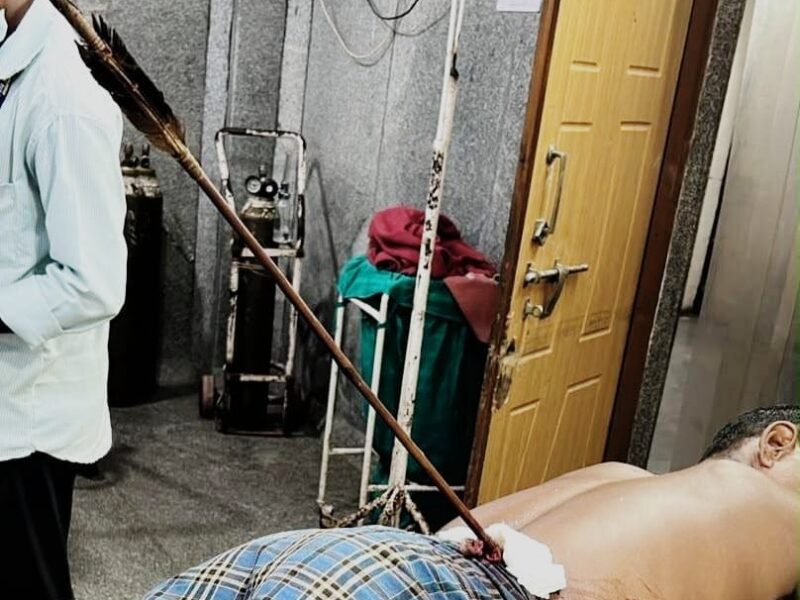 Ambedkar Hospital: A medical miracle at Mekahara, Raipur! Successful surgery on a patient injured by an arrow... doctors saved his life.