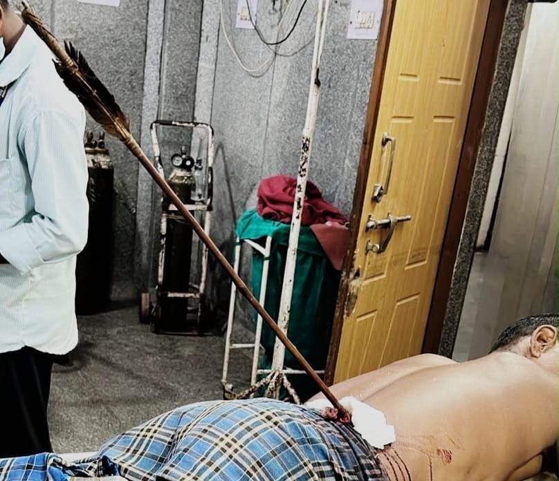 Ambedkar Hospital: A medical miracle at Mekahara, Raipur! Successful surgery on a patient injured by an arrow... doctors saved his life.