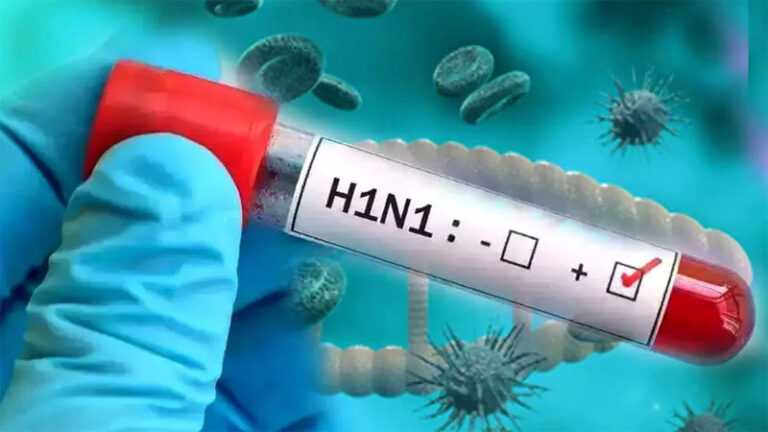 H1N1 infection